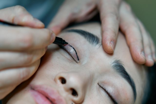 Blefaroplastyka
